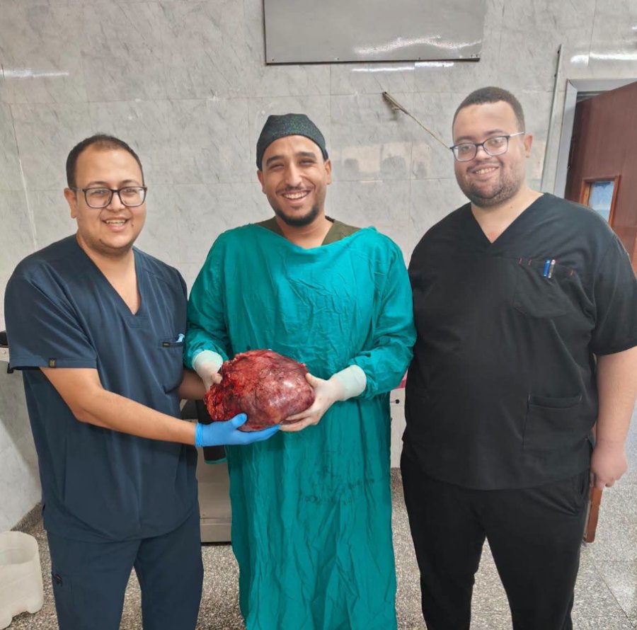 إنجاز طبي جديد بصعيد مصر: فريق جراحي بجامعة أسيوط يستأصل ورمًا مبيضيًا ضخمًا لـ"خمسينية"